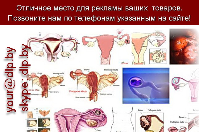 Запрос: «внематочная беременность признаки», рубрика: Медицина