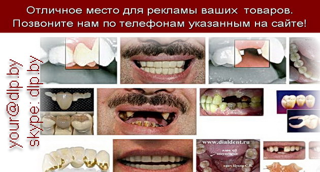 протезирование зубов без обточки